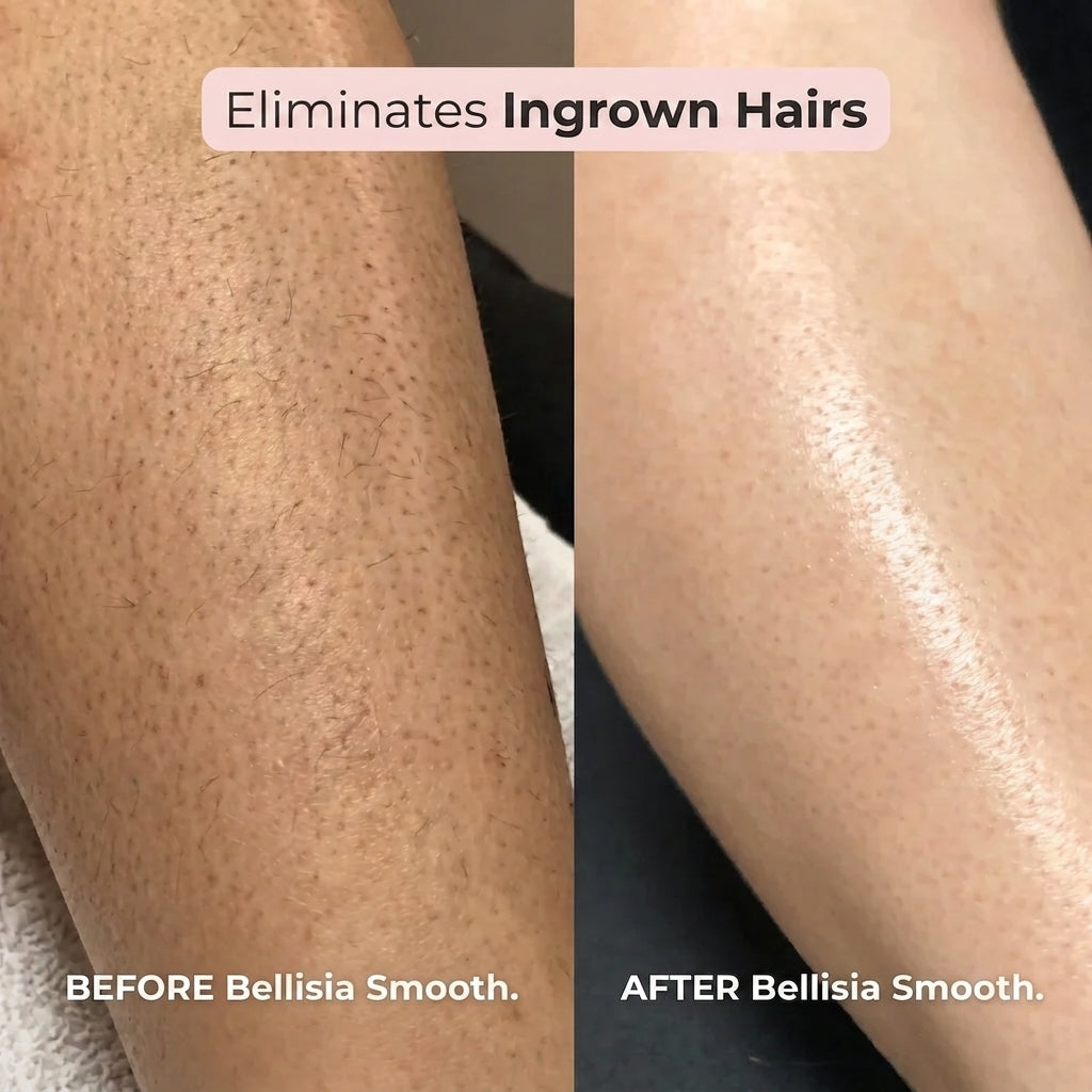 Bellisia Smooth